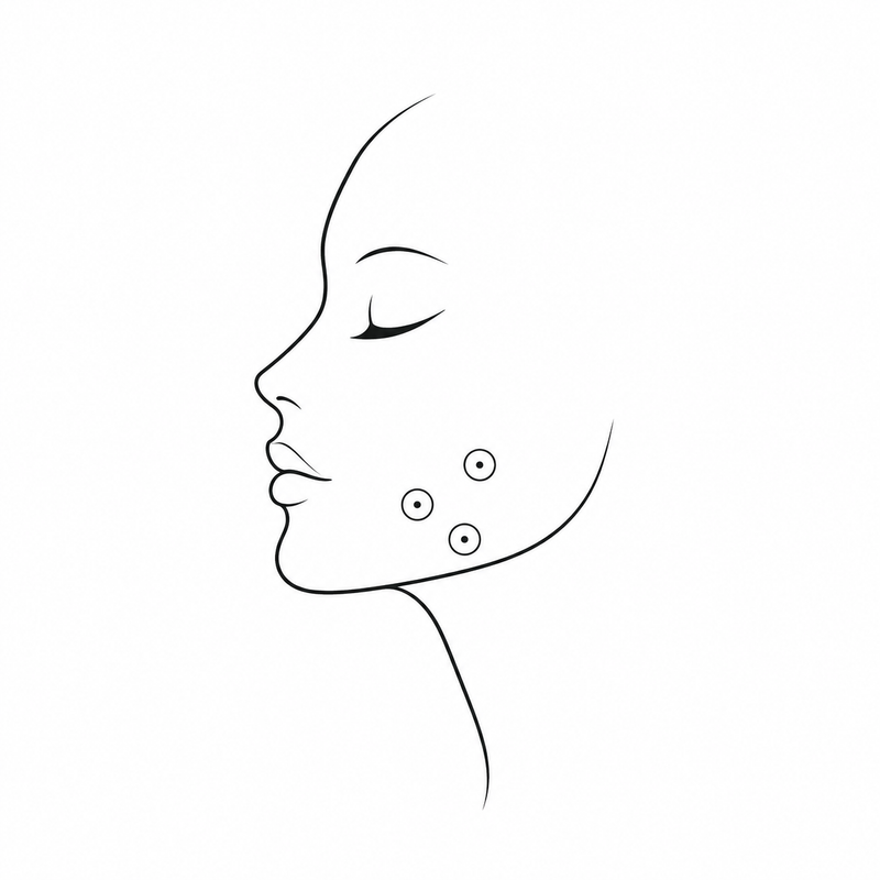 Acne & Blemishes